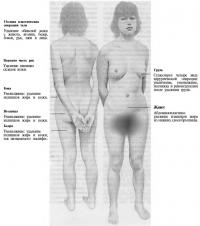 Косметические операции на теле